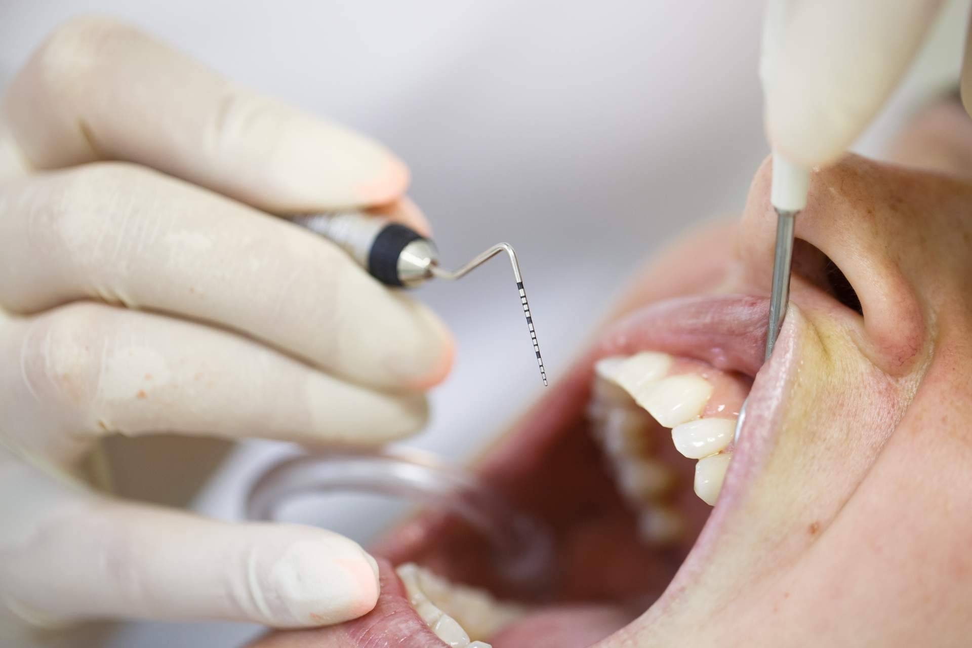 Eira Dental, servicios expertos en endodoncia y periodoncia